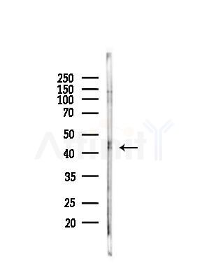 Phospho-TTF1 (Ser23) Antibody - Western blot analysis of lysates from Hela cells(starvation,24h treatment), using Phospho-TTF1 (Ser23) Antibody at 1/1000 dilution.