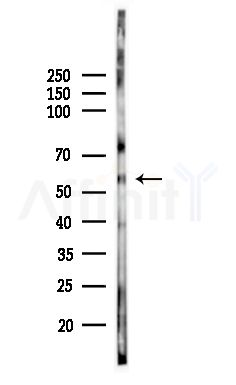 Phospho-SLC32A1 (Ser462) Antibody - Western blot analysis of lysates from Mouse brain, using Phospho-SLC32A1 (Ser462) Antibody at 1/1000 dilution.