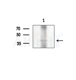 Phospho-KMT5A (Ser100) Antibody - Western blot analysis of lysates from Hela cells(starvation treatment), using Phospho-KMT5A (Ser100) Antibody at 1/1000 dilution.