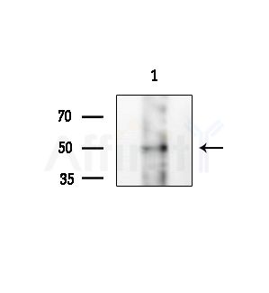 Phospho-KMT5A (Ser100) Antibody - Western blot analysis of lysates from 293 cells(UV treatment), using Phospho-KMT5A (Ser100) Antibody at 1/1000 dilution.