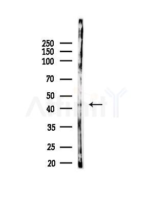 Phospho-KMT5A (Ser100) Antibody - Western blot analysis of lysates from 293 cells(UV,30min treatment), using Phospho-KMT5A (Ser100) Antibody at 1/1000 dilution.