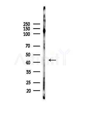 Phospho-KMT5A (Ser100) Antibody - Western blot analysis of lysates from Hela cells(starvation,24h treatment), using Phospho-KMT5A (Ser100) Antibody at 1/1000 dilution.