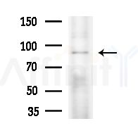 Phospho-BCL11A (Ser205) Antibody - Western blot analysis of extracts from HepG2 cells(LPS,4h treatment), using Phospho-BCL11A (Ser205) Antibody at 1/1000 dilution.