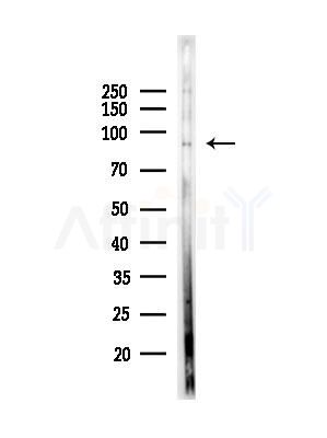 Phospho-BCL11A (Ser205) Antibody - Western blot analysis of lysates from HepG2 cells(LPS, 4h treatment), using Phospho-BCL11A (Ser205) Antibody at 1/1000 dilution.