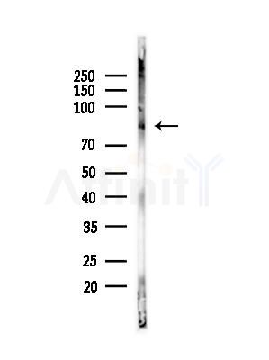 Phospho-PFKM (Ser74) Antibody - Western blot analysis of lysates from Hela cells(starvation,24h treatment), using Phospho-PFKM (Ser74) Antibody at 1/1000 dilution.