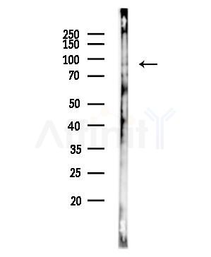 Phospho-CDC5L (Tyr232) Antibody - Western blot analysis of lysates from PC12 cells(UV,30min treatment), using Phospho-CDC5L (Tyr232) Antibody at 1/1000 dilution.