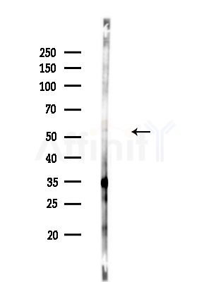 Phospho-TAB1 (Tyr481) Antibody - Western blot analysis of lysates from HUVEC cells, using Phospho-TAB1 (Tyr481) Antibody at 1/1000 dilution.