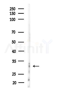 Phospho-Occludin (Tyr287) Antibody - Western blot analysis of lysates from B16F10-LUC cells(starvation,24h treatment), using Phospho-Occludin (Tyr287) Antibody at 1/1000 dilution.