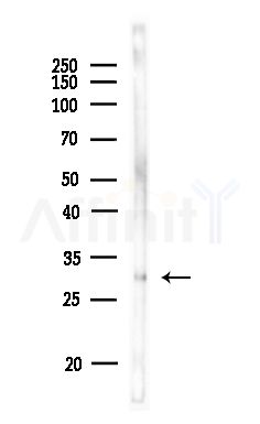 Phospho-Occludin (Tyr287) Antibody - Western blot analysis of lysates from MDA-MB-231 cells(heat-shock,45min treatment), using Phospho-Occludin (Tyr287) Antibody at 1/1000 dilution.
