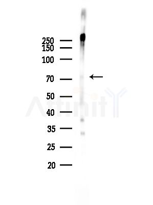 Phospho-TRIM32 (Ser339) Antibody - Western blot analysis of lysates from HepG2 cells(starvation,24h treatment), using Phospho-TRIM32 (Ser339) Antibody at 1/1000 dilution.