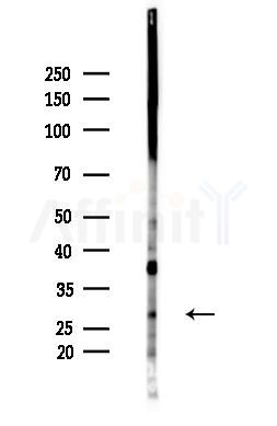 Phospho-HES1 (Ser37) Antibody - Western blot analysis of lysates from LoVo cells(heat-shock,45min treatment), using Phospho-HES1 (Ser37) Antibody at 1/1000 dilution.