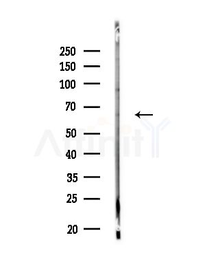 Phospho-USP22 (Thr147) Antibody - Western blot analysis of lysates from HUVEC cells, using Phospho-USP22 (Thr147) Antibody at 1/1000 dilution.