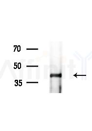 Phospho-osterix (Thr319) Antibody - Western blot analysis of extracts from Mouse brain, using Phospho-osterix (Thr319) Antibody at 1/1000 dilution.