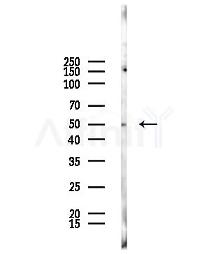 Phospho-PINK1 (Ser228) Antibody - Western blot analysis of lysates from EC304 cells, using Phospho-PINK1 (Ser228) Antibody at 1/1000 dilution.