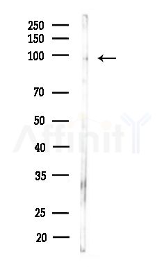 Phospho-CUL4B (Thr48) Antibody - Western blot analysis of lysates from B16F10-LUC cells(starvation,24h treatment), using Phospho-CUL4B (Thr48) Antibody at 1/1000 dilution.