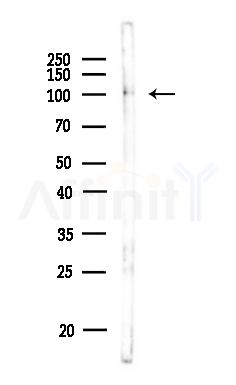 Phospho-CUL4B (Thr48) Antibody - Western blot analysis of lysates from MDA-MB-231 cells(heat-shock,45min treatment), using Phospho-CUL4B (Thr48) Antibody at 1/1000 dilution.