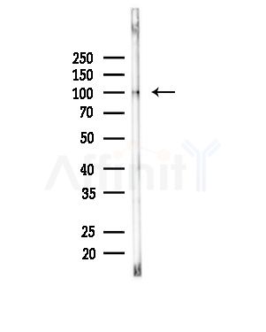 Phospho-BACH1 (Ser445) Antibody - Western blot analysis of lysates from Mouse brain, using Phospho-BACH1 (Ser445) Antibody at 1/1000 dilution.