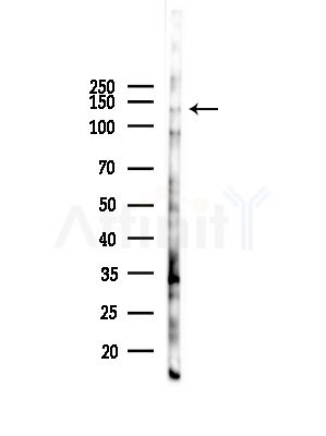 Phospho-ABCB11 (Ser690) Antibody - Western blot analysis of lysates from HepG2 cells(starvation,24h treatment), using Phospho-ABCB11 (Ser690) Antibody at 1/1000 dilution.