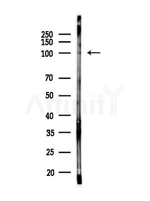 Phospho-ARHGAP42 (Tyr376) Antibody - Western blot analysis of lysates from PC12 cells(LPS, 4h treatment), using Phospho-ARHGAP42 (Tyr376) Antibody at 1/1000 dilution.