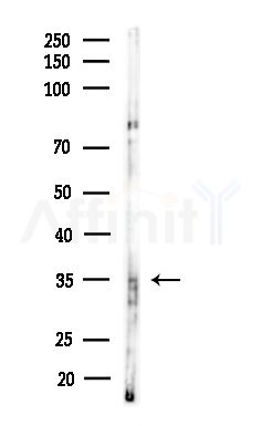 Phospho-Annexin A2 (Tyr24) Antibody - Western blot analysis of lysates from B16F10-LUC cells(starvation,24h treatment), using Phospho-Annexin A2 (Tyr24) Antibody at 1/1000 dilution.