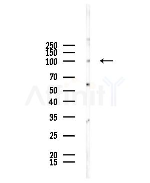 Phospho-PLD2 (Tyr511) Antibody - Western blot analysis of lysates from EC304 cells, using Phospho-PLD2 (Tyr511) Antibody at 1/1000 dilution.