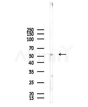 Phospho-MDM4 (Ser367) Antibody - Western blot analysis of lysates from EC304 cells, using Phospho-MDM4 (Ser367) Antibody at 1/1000 dilution.