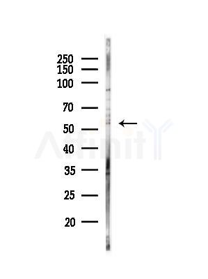 Phospho-MDM4 (Ser342) Antibody - Western blot analysis of lysates from EC304 cells(heat-shock,45min treatment), using Phospho-MDM4 (Ser342) Antibody at 1/1000 dilution.