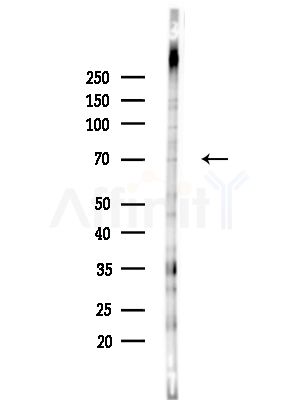 Phospho-TAK1 (Ser192) Antibody - Western blot analysis of lysates from HUVEC cells, using Phospho-TAK1 (Ser192) Antibody at 1/1000 dilution.