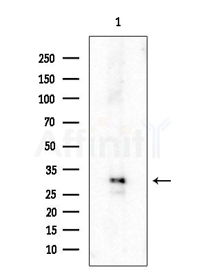 Phospho-SGTA (Ser301) Antibody - Western blot analysis of extracts from HUVEC cells, using Phospho-SGTA (Ser301) Antibody at 1/1000 dilution.