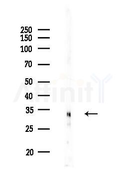 Phospho-SGTA (Ser301) Antibody - Western blot analysis of lysates from HUVEC cells, using Phospho-SGTA (Ser301) Antibody at 1/1000 dilution.