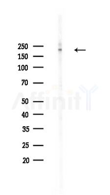 Phospho-KIF1B (Ser1057) Antibody - Western blot analysis of lysates from HepG2 cells(heat-shock,45min treatment), using Phospho-KIF1B (Ser1057) Antibody at 1/1000 dilution.