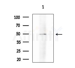 Phospho-DOK2 (Tyr402) Antibody - Western blot analysis of extracts from HepG2 cells
(heat-shock treatment), using Phospho-DOK2 (Tyr402) Antibody at 1/1000 dilution.
