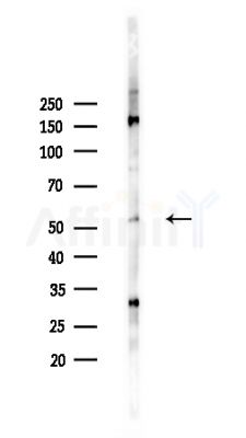 Phospho-DOK2 (Tyr402) Antibody - Western blot analysis of lysates from HepG2 cells(heat-shock,45min treatment), using Phospho-DOK2 (Tyr402) Antibody at 1/1000 dilution.