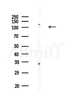 Phospho-TLR5 (Ser805) Antibody - Western blot analysis of lysates from HUVEC cells, using Phospho-TLR5 (Ser805) Antibody at 1/1000 dilution.