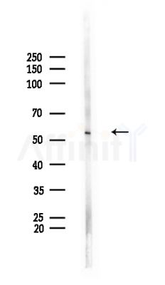 Phospho-PFKFB2 (Ser32) Antibody - Western blot analysis of lysates from Rat brain, using Phospho-PFKFB2 (Ser32) Antibody at 1/1000 dilution.