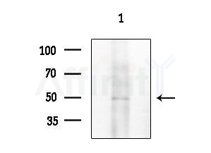 Phospho-MITF (Ser414) Antibody - Western blot analysis of extracts from HepG2 cells
(heat-shock treatment), using Phospho-MITF (Ser414) Antibody at 1/1000 dilution.
