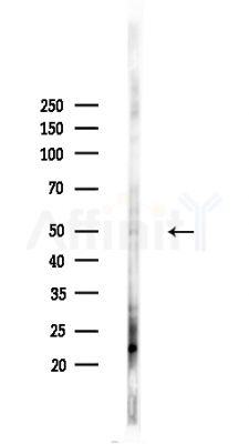 Phospho-MITF (Ser414) Antibody - Western blot analysis of lysates from HepG2 cells(heat-shock,45min treatment), using Phospho-MITF (Ser414) Antibody at 1/1000 dilution.