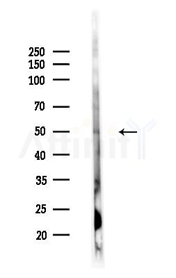 Phospho-MITF (Ser414) Antibody - Western blot analysis of lysates from PC12 cells(LPS,4h treatment), using Phospho-MITF (Ser414) Antibody at 1/1000 dilution.