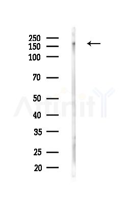 Phospho-ROCK2 (Ser1366) Antibody - Western blot analysis of lysates from HUVEC cells(starvation,24h treatment), using Phospho-ROCK2 (Ser1366) Antibody at 1/1000 dilution.