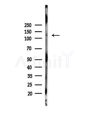 Phospho-ULK1 (Ser450) Antibody - Western blot analysis of lysates from Hela cells(heat-shock,45min treatment), using Phospho-ULK1 (Ser450) Antibody at 1/1000 dilution.