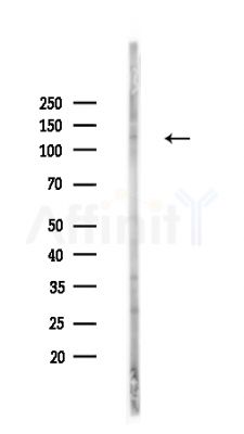 Phospho-ULK1 (Thr1046) Antibody - Western blot analysis of lysates from HepG2 cells(heat-shock,45min treatment), using Phospho-ULK1 (Thr1046) Antibody at 1/1000 dilution.