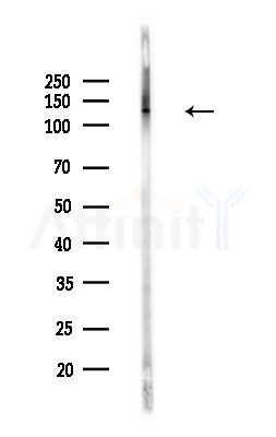Phospho-ULK1 (Thr1046) Antibody - Western blot analysis of lysates from PC12 cells(LPS,4h treatment), using Phospho-ULK1 (Thr1046) Antibody at 1/1000 dilution.
