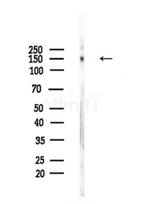 Phospho-SF3B1 (Thr211) Antibody - Western blot analysis of lysates from Mouse brain, using Phospho-SF3B1 (Thr211) Antibody at 1/1000 dilution.