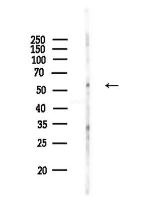 Phospho-Dab1 (Tyr198) Antibody - Western blot analysis of lysates from COLO205 cells(heat-shock,45min treatment), using Phospho-Dab1 (Tyr198) Antibody at 1/1000 dilution.