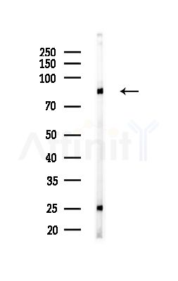 Phospho-MSK2 (Ser360) Antibody - Western blot analysis of lysates from HUVEC cells(starvation,24h treatment), using Phospho-MSK2 (Ser360) Antibody at 1/1000 dilution.
