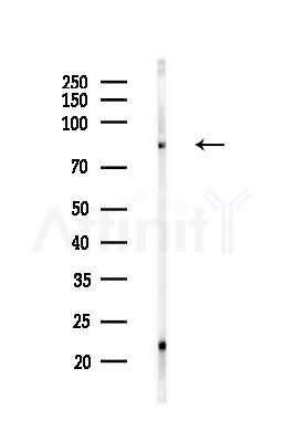 Phospho-MSK2 (Ser360) Antibody - Western blot analysis of lysates from A375 cells(starvation,24h treatment), using Phospho-MSK2 (Ser360) Antibody at 1/1000 dilution.