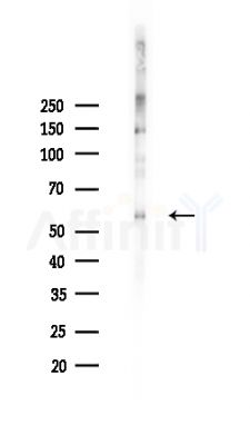 Phospho-STAM2 (Tyr371) Antibody - Western blot analysis of lysates from HepG2 cells(heat-shock,45min treatment), using Phospho-STAM2 (Tyr371) Antibody at 1/1000 dilution.