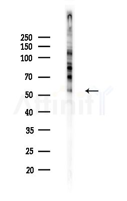 Phospho-STAM2 (Tyr371) Antibody - Western blot analysis of lysates from PC12 cells(LPS,4h treatment), using Phospho-STAM2 (Tyr371) Antibody at 1/1000 dilution.