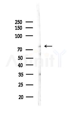 Phospho-RAD17 (Ser359) Antibody - Western blot analysis of lysates from HepG2 cells(heat-shock,45min treatment), using Phospho-RAD17 (Ser359) Antibody at 1/1000 dilution.