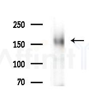 Phospho-NFAT5 (Ser134) Antibody - Western blot analysis of extracts from B16F10-LUC cells(starvation,24h treatment), using Phospho-NFAT5 (Ser134) Antibody at 1/1000 dilution.